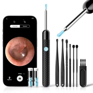 Otoscope Oreille 1080P HD Camera Oreille Nettoyage avec 6 LED Lumières - Équipé de 7 Cure-Oreilles Traditionnels - Nettoyeur Oreille Compatible iOS & Android (Noir Brillant)